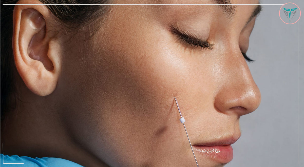 نخ دوسوزنه Double Needle نوبل