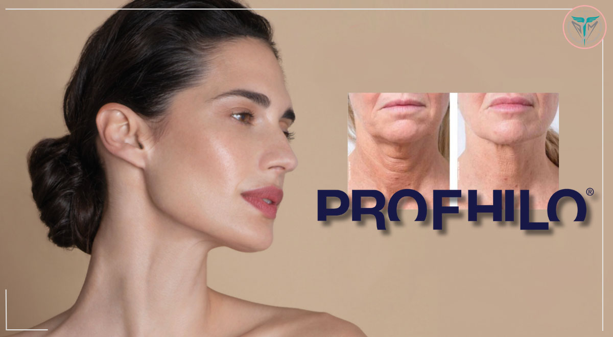نمایندگی مزوژل ایتالیایی پروفایلو