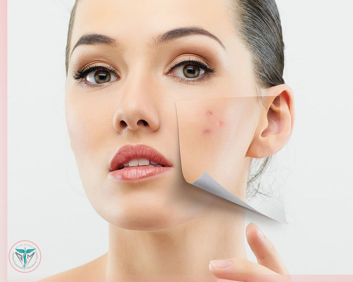 نمایندگی کوکتل مزوتراپی ضد آکنه
