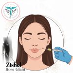 خرید فیلر سینگدرم