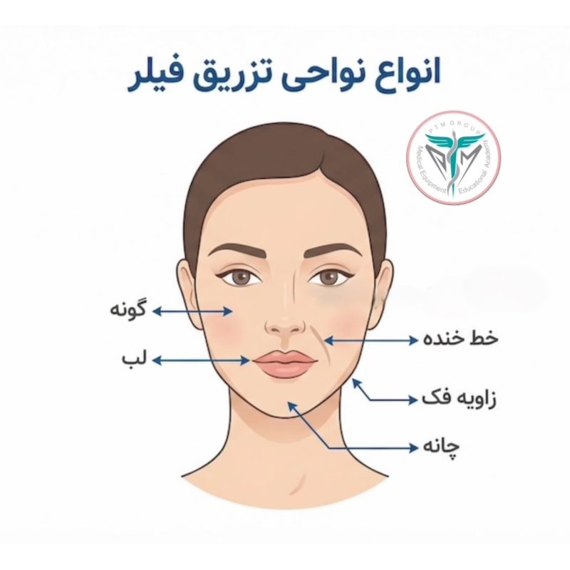 کمترین قیمت فیل مکس فیل