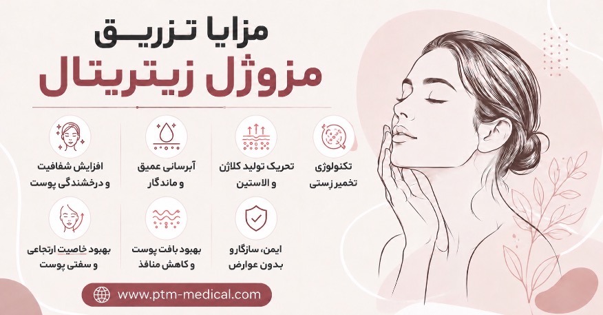 مزایای تزریق زیتریتال